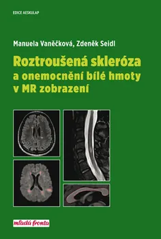 Roztroušená skleróza a onemocnění bílé hmoty v MR zobrazení - Zdeněk Seidl, Manuela Vaněčková (2018, pevná bez přebalu lesklá)