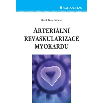 Arteriální revaskularizace myokardu