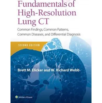 Fundamentals of High-Resolution Lung CT – Elicker,Brett M,MD,W. Richard Webb (EN)