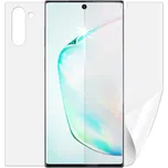 Screenshield folie na celé tělo pro…