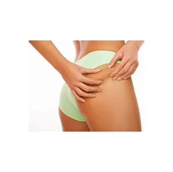 Homeopatikum Celulitida-sada