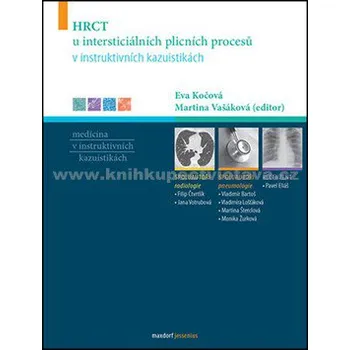 HRCT u intersticiálních plicních procesů v instruktivních kazuistikách - Eva Kočová a kol. HRCT u intersticiálních plicních procesů v instruktivních kazuistikách - Eva Kočová a kol.