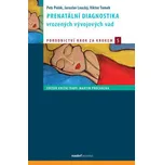 Prenatální diagnostika vrozených…