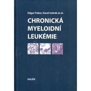 Chronická myeloidní leukémie - Edgar Faber, Karel Indrák