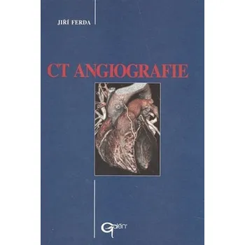 CT Angiografie - Jiří Ferda CT Angiografie - Jiří Ferda