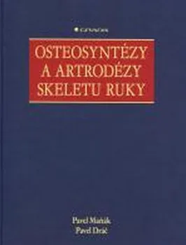 Osteosyntézy a artrodézy skeletu ruky - Pavel Maňák