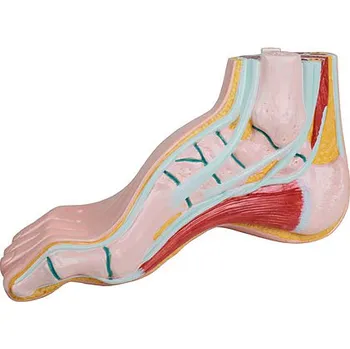 Erler-Zimmer Model vbočeného palce, halux valgus