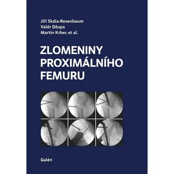 Zlomeniny proximálního femuru - Jiří Skála-Rosenbaum a kol. (2019, pevná bez přebalu)