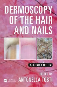 Cizojazyčná kniha Dermoscopy of the Hair and Nails (2nd Edition) - Antonella Tosti (EN)
