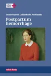 Postpartum hemorrhage - Petr Křepelka a…