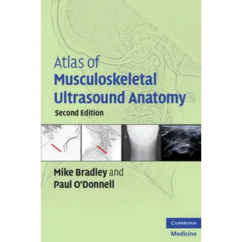 Atlas of Musculoskeletal Ultrasound…