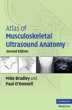 Atlas of Musculoskeletal Ultrasound Anatomy - Mike Bradley, Paul O'Donnell [EN] (2009, brožovaná, 2nd Edition)