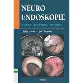 Neuroendoskopie - Zdeněk Novák, Jan Chrastina