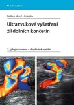 Ultrazvukové vyšetření žil dolních…