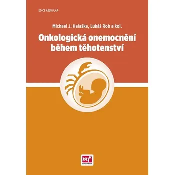 Onkologická onemocnění během těhotenství - Michael J. Halaška a kol.