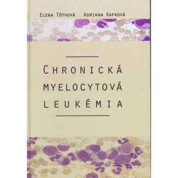 Chronická myelocytová leukémia - Adriana Kafková