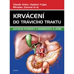 Krvácení do trávicího traktu: Aktuální…