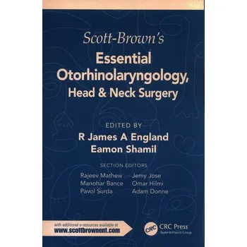 Scott-Brown's Essential Otorhinolaryngology, Head & Neck Surgery - of England, King James I