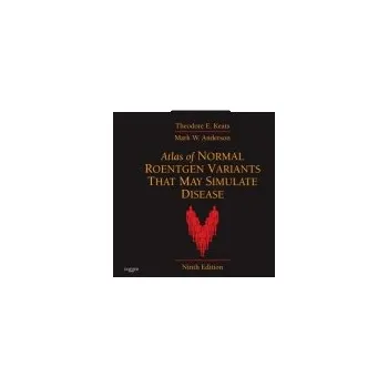 Atlas of Normal Roentgen Variants That May Simulate Disease - Keats, Theodore E. (Alumni Professor of Radiology, Department of Radiology, University of Virginia Health Systems, Charlottesville, VA) a Anderson, Mark W. (Harrison Distinguished Teaching Prof