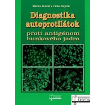 Diagnostika autoprotilátok proti antigénom bunkového jadra - Marián Benčat, Július Rajčáni
