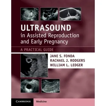 Ultrasound in Assisted Reproduction and Early Pregnancy - Jane Fonda