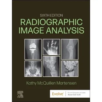 Cizojazyčná kniha Radiographic Image Analysis - Martensen, Kathy McQuillen, MA, RT(R) (Director of Radiologic Technology Education, Department of Radiology, The University of Iowa Hospitals and Clinics, Iowa City, Iowa, USA)
