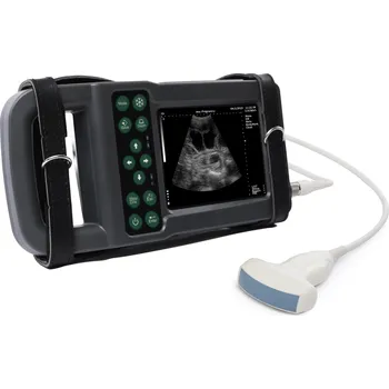 Ultrazvukový skener KX5600L s digitální abdominální sondou