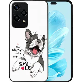 Příslušenství pro tablet VSECHNONAMOBIL 88612 MY ART Ochranný kryt pro Honor 200 Lite SMILE (189)