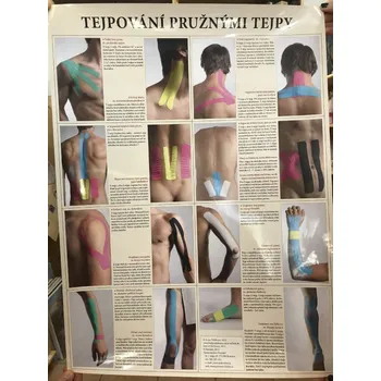 Mapa tejpování pružnými tejpy