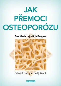 Jak přemoci osteoporózu - Anna Maria Lajusticia Bergasa (2018, brožovaná)