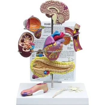 Cukrovka 2. typu - sada