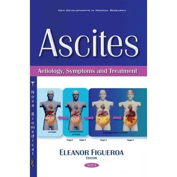 Ascites: Aetiology, Symptoms &…