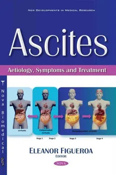 Ascites: Aetiology, Symptoms & Treatment - Eleanor Figueroa [EN] (2016, brožovaná)
