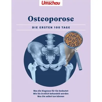 Apotheken Umschau: Osteoporose - Wort & Bild Verlag