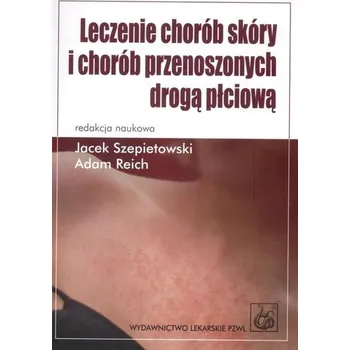 Leczenie chorób skóry i chorób przenoszonych drogą płciową - Szepietowski Jacek, Reich Adam
