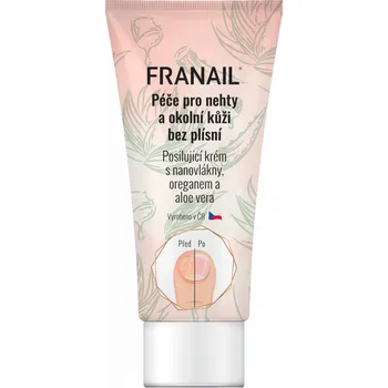 FRANAIL Krém pro nehty a okolní kůži bez plísní 50 ml