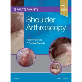 Gartsman's Shoulder Arthroscopy – Hussein Elkousy,T. Bradley Edwards (EN)
