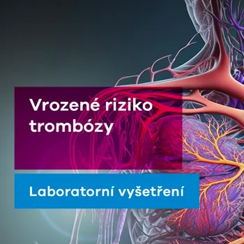 Diagnostický test Vrozené riziko trombózy