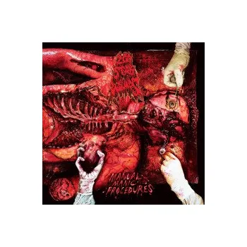 Zahraniční hudba Manual Manic Procedures - 200 Stab Wounds [CD]