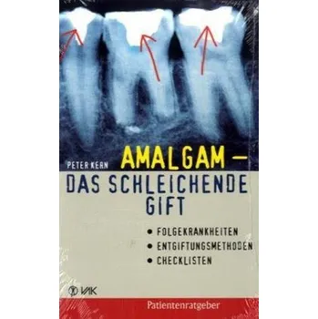 Amalgam - das schleichende Gift - Kern, Peter
