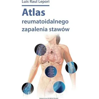 Atlas reumatoidalnego zapalenia stawów - Luis Raul Lepori
