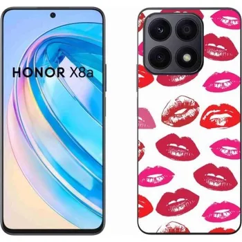 Pouzdro na mobilní telefon Gelový kryt mmCase na mobil Honor X8a - rty