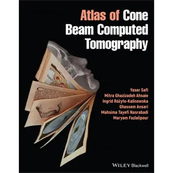 Atlas of Cone Beam Computed Tomography – Yaser Safi,Mitra G. Ahsaie,Ingrid Roxylo-Kalinowska,Ghassem Ansari,Mahsima Tayefi,Maryam Fazlalipour (EN)