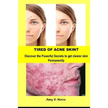 Cizojazyčná kniha TIRED OF ACNE SKIN? Discover the Powerful Secrets to get clearer skin Permanently – Amy D. Morse (EN)
