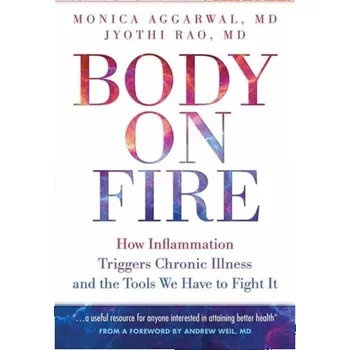 Body On Fire - Aggarwal, Monica; Rao, Jyothi