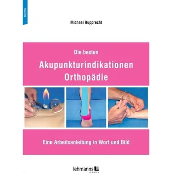 Die besten Akupunkturindikationen Orthopädie - Hofbeck, Michael; Deeg, Karl-Heinz; Rupprecht, Thomas