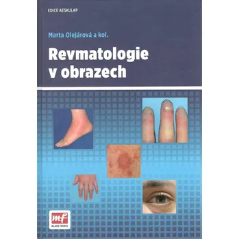 Umění Revmatologie v obrazech