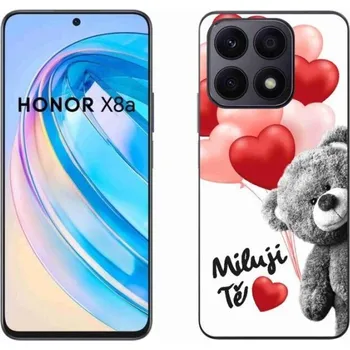 Pouzdro na mobilní telefon Gelový kryt mmCase na mobil Honor X8a - miluji Tě