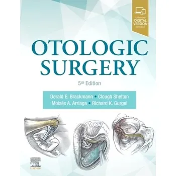 Otologic Surgery