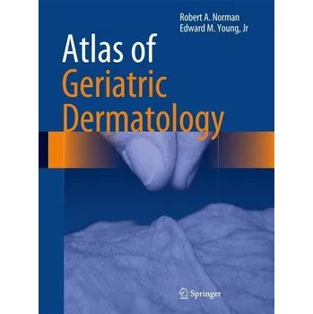 Atlas of Geriatric Dermatology - Robert…